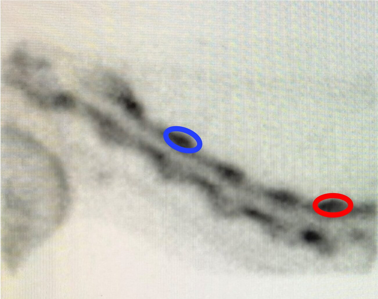 Close-up grayscale microscopic or radiographic image of a linear biological structure with multiple dark spots along its length. Two spots are highlighted—one in blue near the center and one in red toward the right end—indicating regions of interest.