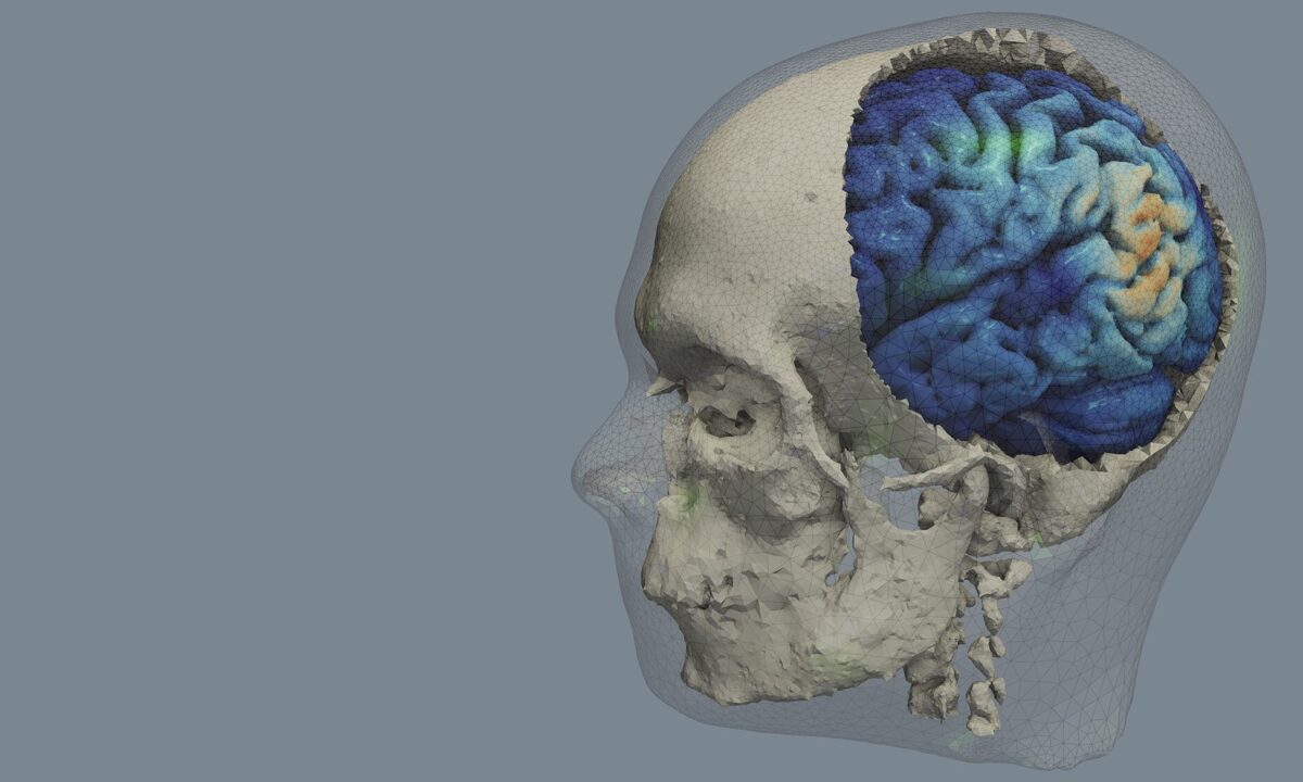 ScaDS.AI Early Career Innovation Projects: NIBSdose.ai